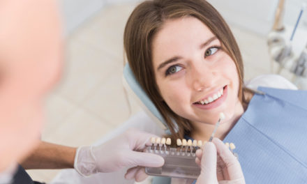 Wybielanie zębów – metody, efekty, przeciwwskazania, cena, opinie