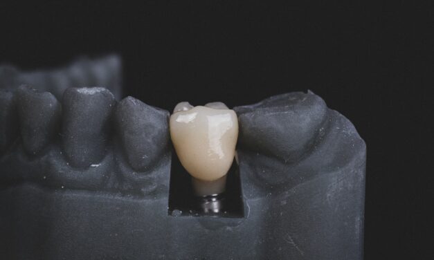 Implant zęba – czy jest dla każdego?