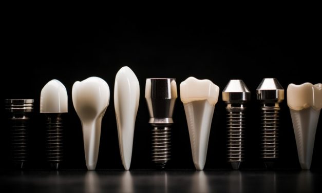 Jakie są rodzaje implantów stomatologicznych?